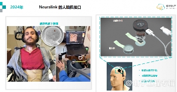 植入式脑机接口，开启意识与AI融合的可能性(图3)